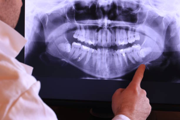 Best Emergency Dental Services for Seniors in Marysville, MI