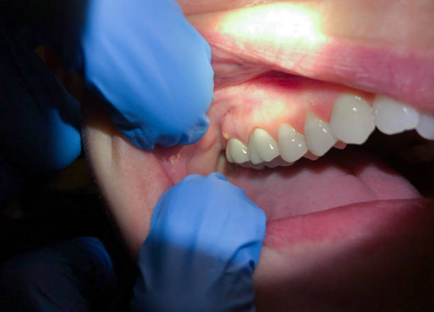 Best Broken or Cracked Tooth Emergency Dentist in Marysville, MI